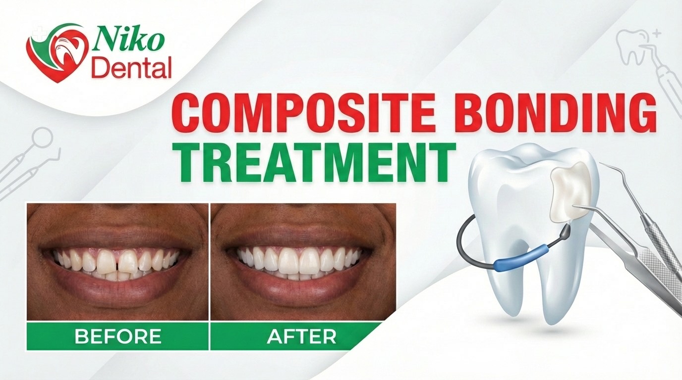 Composite Bonding